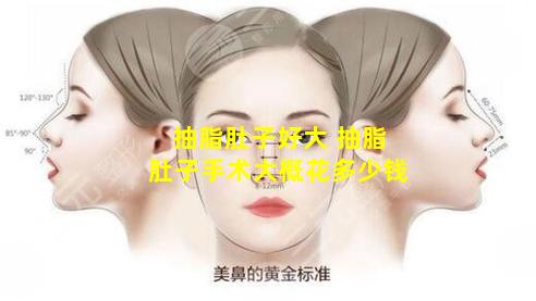 抽脂肚子好大 抽脂肚子手术大概花多少钱